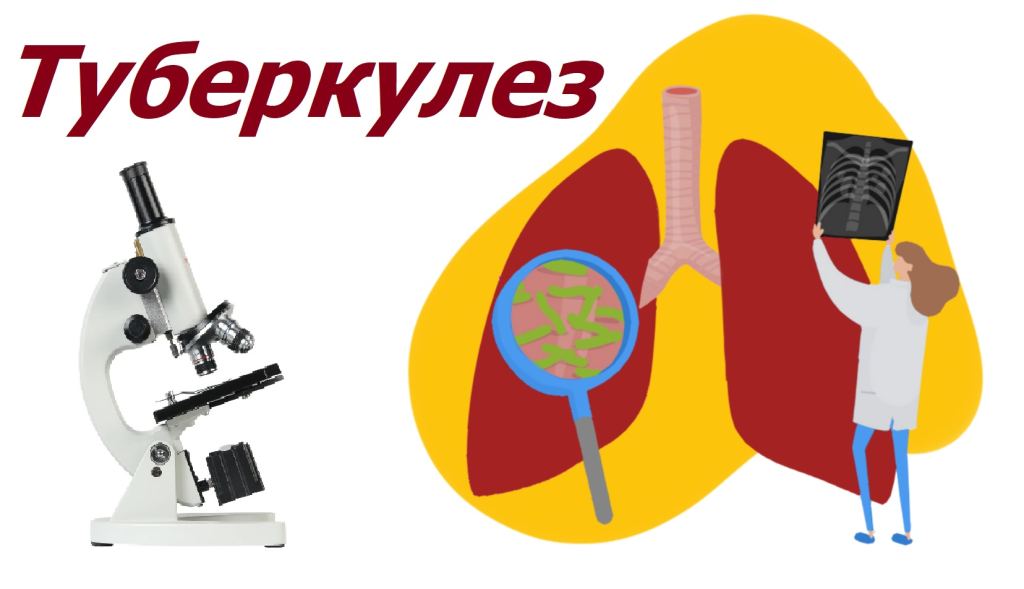 Роспотребнадзор: Туберкулез.