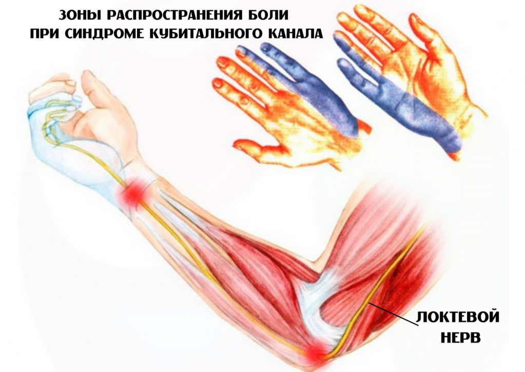 кубит.канал 2.png