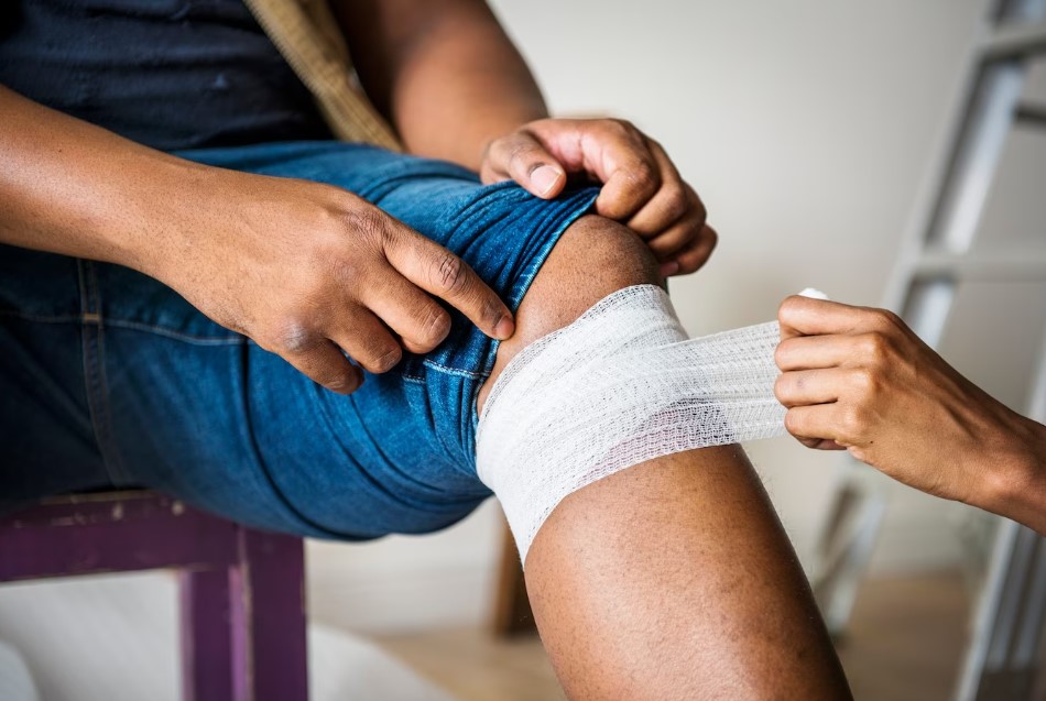 Лечение узловатой эритемы в МЦ