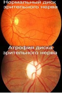 ыва-200x300.jpg